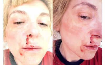 anna-laura-millacci-di-cataldo-abortire